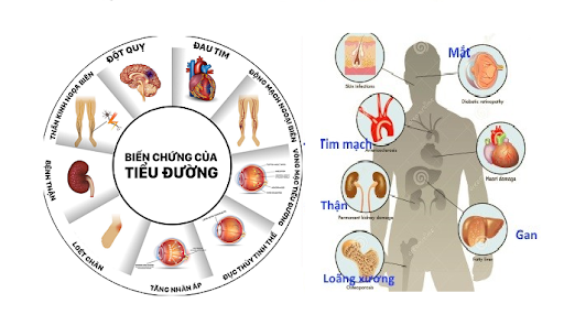 bien-chung-tieu-duong1-1634011673.png