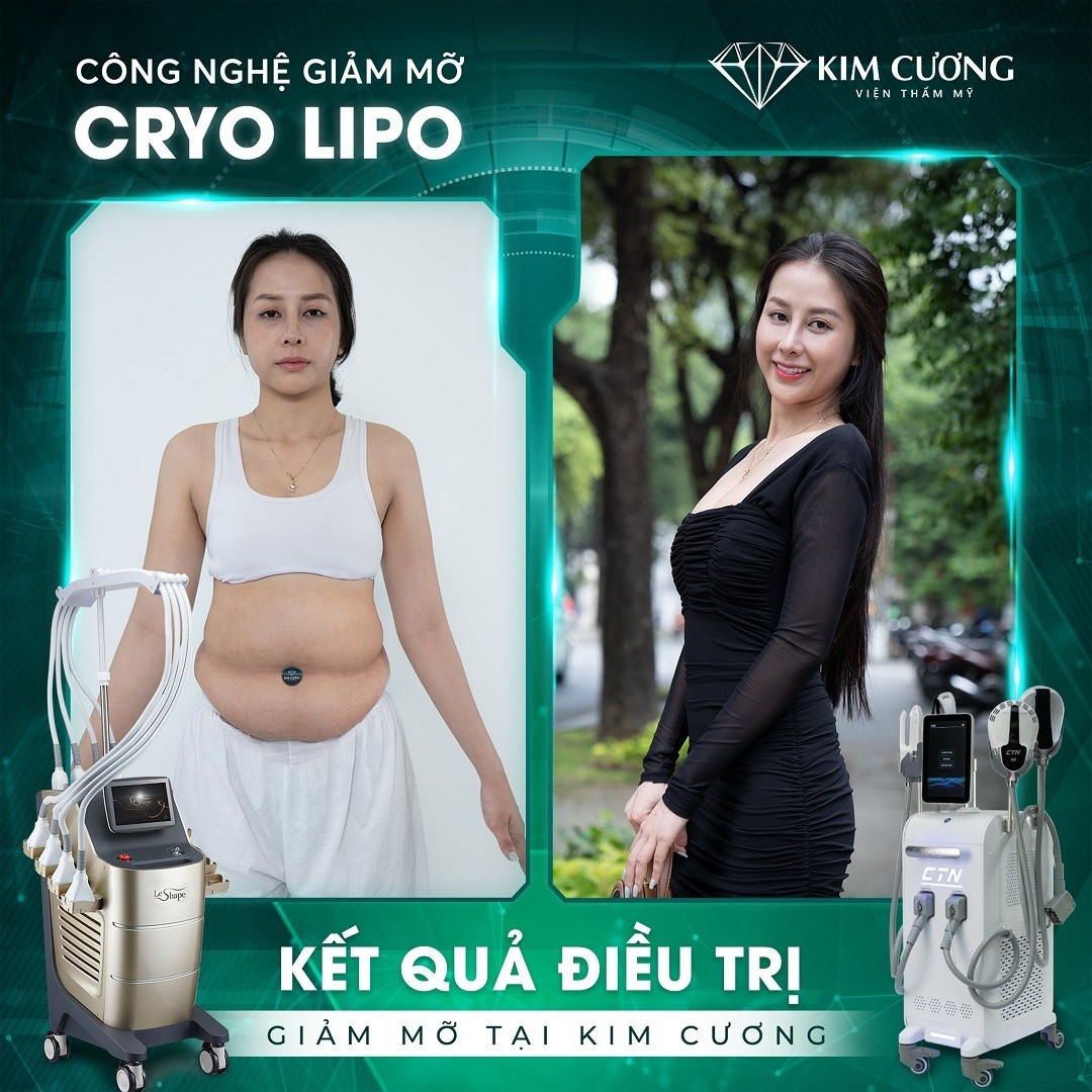 cryolipo3-1671521968.jpg